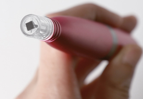 Feather Touch Hautregeneration Erding