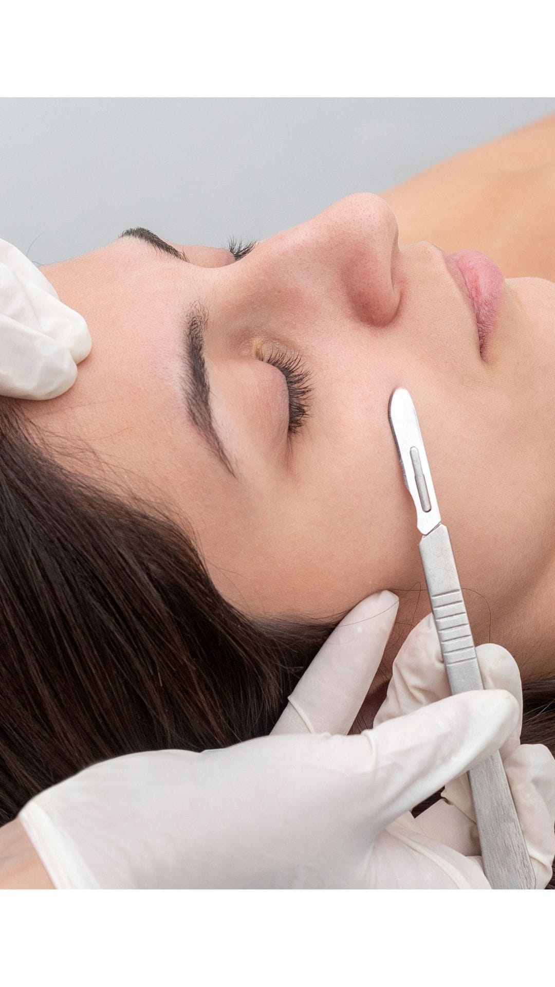Dermaplaning Erding