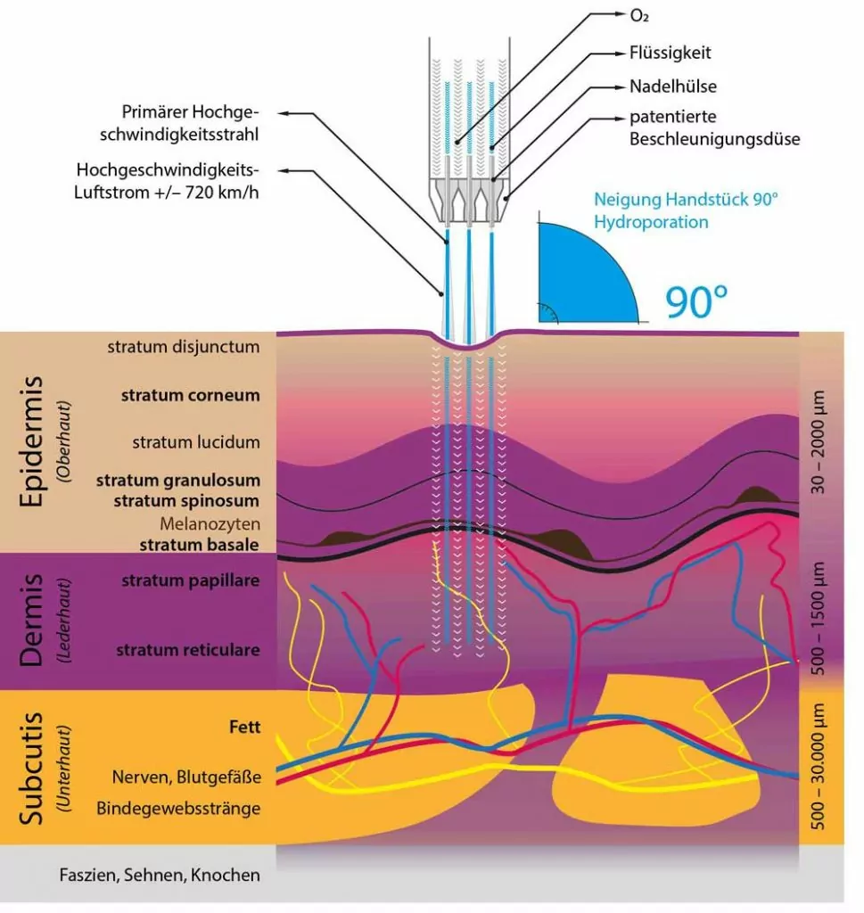 JetPeel Behandlung bei SkinConcept Erding