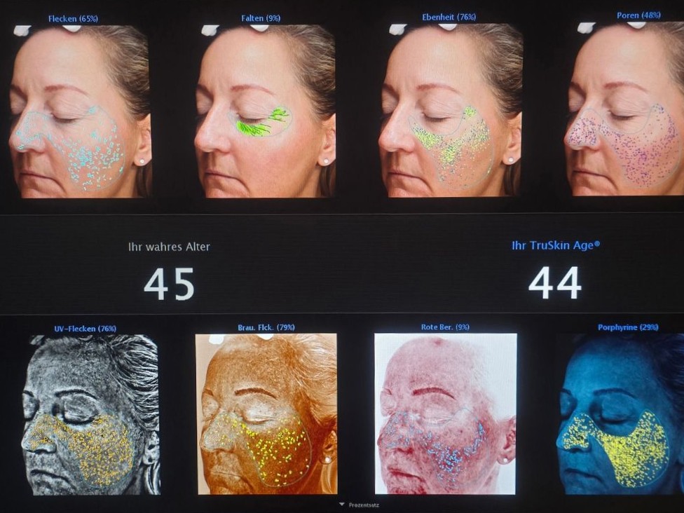 VISIA Analyse SkinConcept Erding