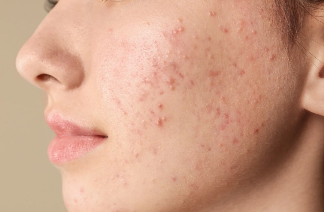 Young Ager Treatment SkinConcept Erding